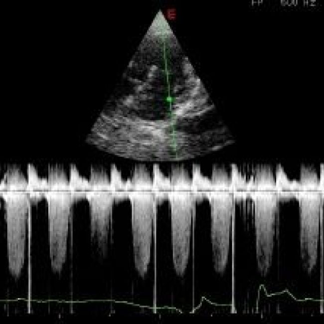 Cardiología veterinaria en León