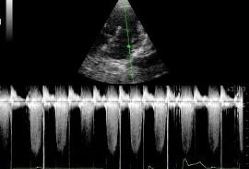 Cardiología veterinaria en León