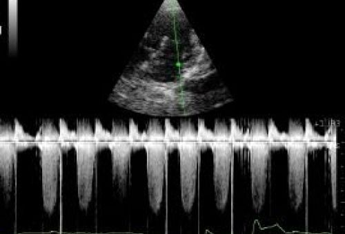 Cardiología veterinaria en León